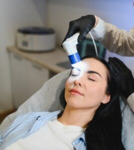 laser skin tightening procedure at Alladerm Orange County showing non-invasive collagen-boosting results
