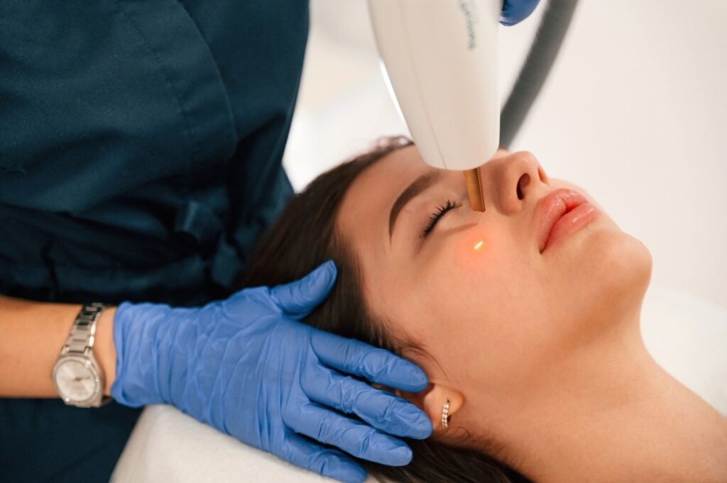 Patient receiving Titan laser tightening treatment at Alladerm in Orange County to boost collagen and firm skin