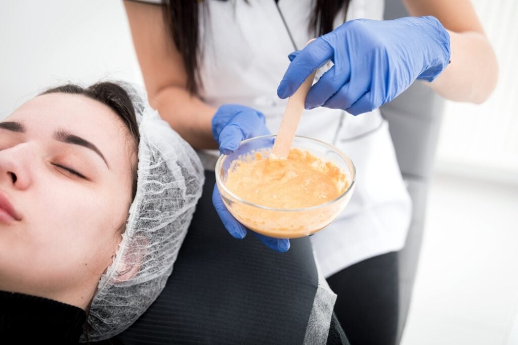 chemical-peel-vs-exfoliation-treatments-alladerm-orange-county