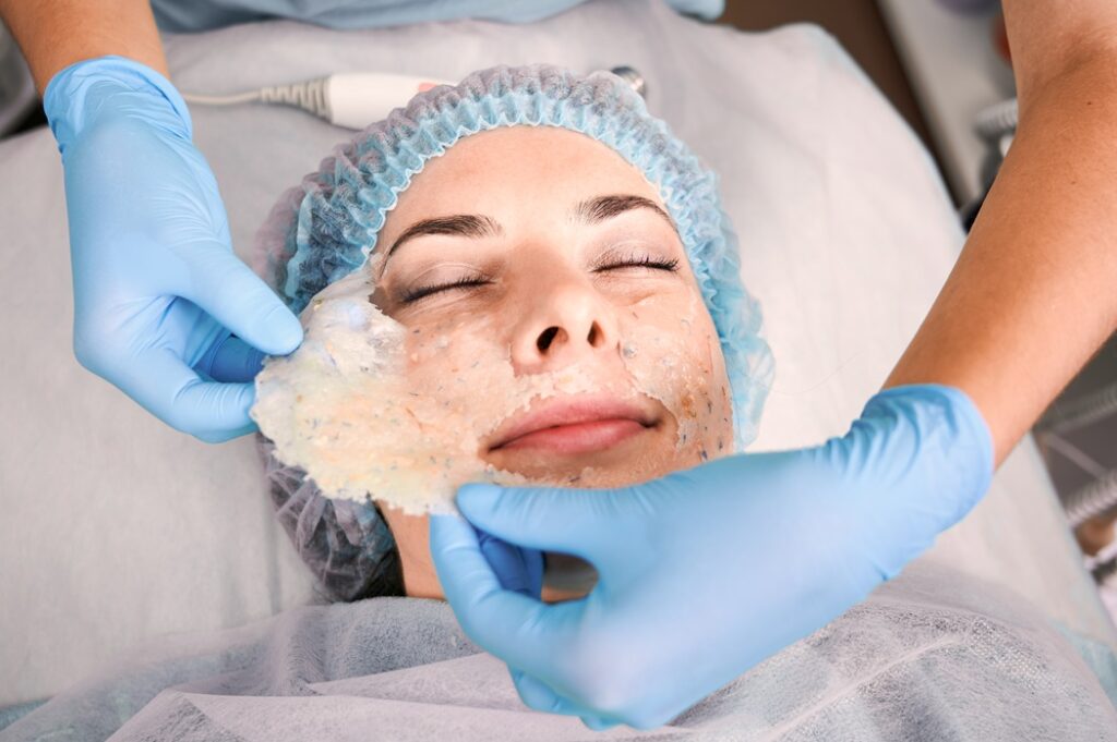 Chemical peel treatments by Alladerm for light, medium, and deep skin rejuvenation options