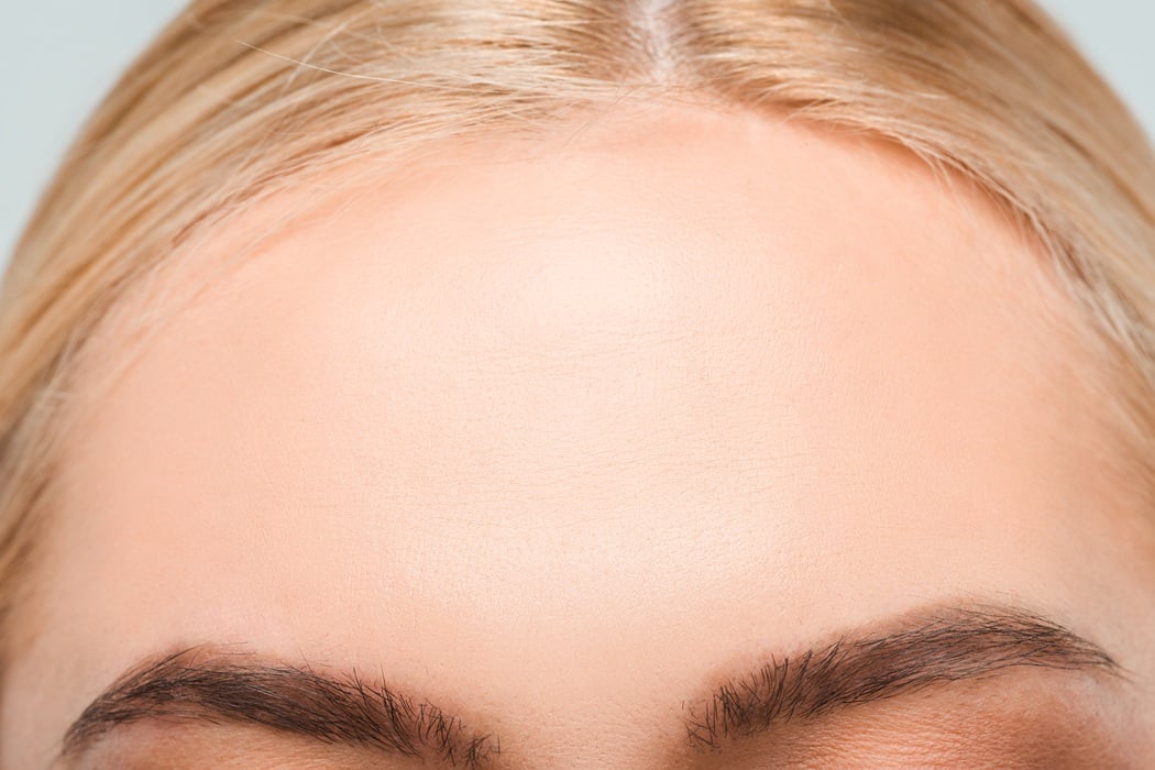 sudden forehead wrinkles and skin rejuvenation options